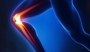 cirugia-artrosis-rodilla